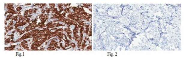 Anti-c-ErbB2/c-Neu Antibody, clone 3B5 clone 3B5, from mouse