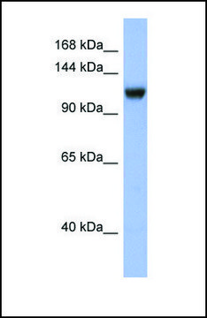 Anti-NR3C2, (N-terminal) antibody produced in rabbit affinity isolated antibody