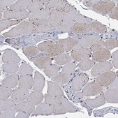 Anti-ARHGAP45 antibody produced in rabbit Prestige Antibodies® Powered by Atlas Antibodies, affinity isolated antibody, buffered aqueous glycerol solution