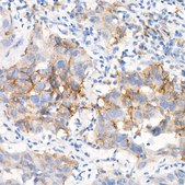Anti-EGFR (L858R) Antibody, clone 1J5C6, Rabbit Monoclonal