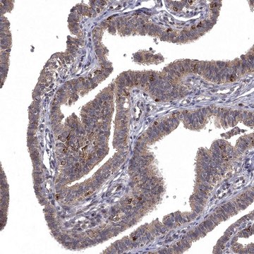 Anti-WDR19 antibody produced in rabbit Prestige Antibodies® Powered by Atlas Antibodies, affinity isolated antibody, buffered aqueous glycerol solution