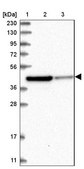 Anti-RTKN antibody produced in rabbit Prestige Antibodies® Powered by Atlas Antibodies, affinity isolated antibody, buffered aqueous glycerol solution