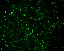 Human Cortical GABAergic Neurons Human iPSC line, Fully differentiated, Healthy Male Control (no known neurological disorders), Cryopreserved