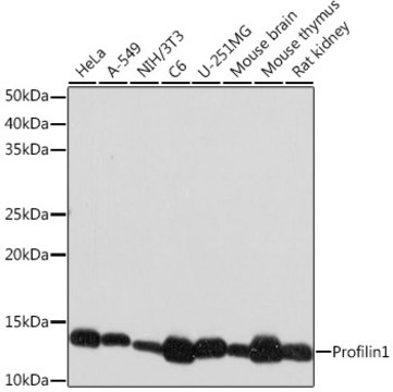 Anti-Profilin1 Antibody, clone 2Z1M4, Rabbit Monoclonal