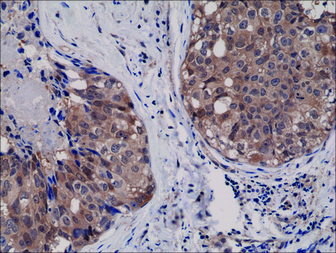 Anti-AKT1 antibody, Rabbit monoclonal recombinant, expressed in HEK 293 cells, clone RM252, purified immunoglobulin