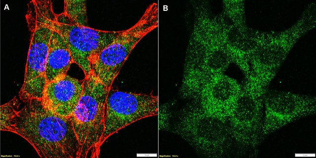 Anti-B-Raf Antibody, clone 2D3 ZooMAb&#174; Rabbit Monoclonal recombinant, expressed in HEK 293 cells