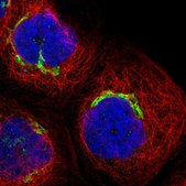 Anti-ACCS antibody produced in rabbit Prestige Antibodies® Powered by Atlas Antibodies, affinity isolated antibody, buffered aqueous glycerol solution, Ab1