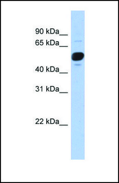 Anti-FRS3 antibody produced in rabbit affinity isolated antibody