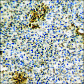 Anti-phospho-CK-1 α (pTyr294) antibody produced in rabbit affinity isolated antibody