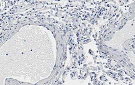 Anti-Elastin Antibody, clone 1G6 ZooMAb® Rabbit Monoclonal recombinant, expressed in HEK 293 cells