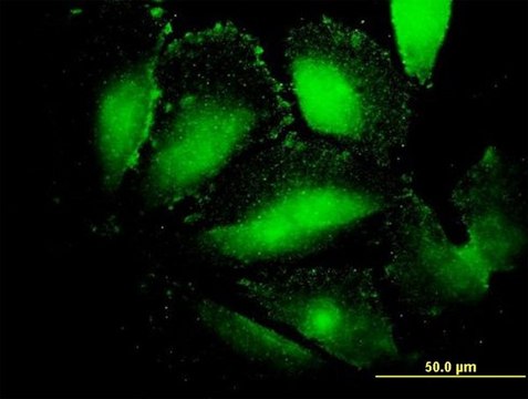 Monoclonal Anti-AFP antibody produced in mouse clone 1G7, purified immunoglobulin, buffered aqueous solution