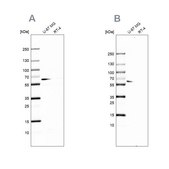 Anti-P4HA2 antibody produced in rabbit Prestige Antibodies® Powered by Atlas Antibodies, affinity isolated antibody, buffered aqueous glycerol solution