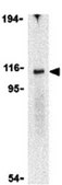 Anti-IRE1p Antibody from rabbit, purified by affinity chromatography