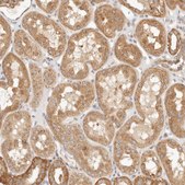 Anti-PTPN22 antibody produced in rabbit Prestige Antibodies® Powered by Atlas Antibodies, affinity isolated antibody, buffered aqueous glycerol solution, ab1