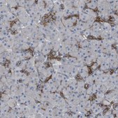 Anti-PREX2 antibody produced in rabbit Prestige Antibodies® Powered by Atlas Antibodies, affinity isolated antibody, buffered aqueous glycerol solution