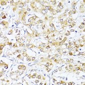 Anti-EIF2S1 antibody produced in rabbit