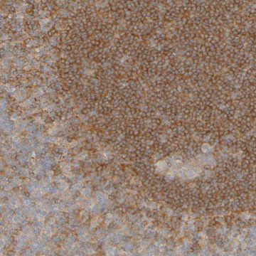 ANTI-APPL1 antibody produced in rabbit Prestige Antibodies&#174; Powered by Atlas Antibodies, affinity isolated antibody, buffered aqueous glycerol solution