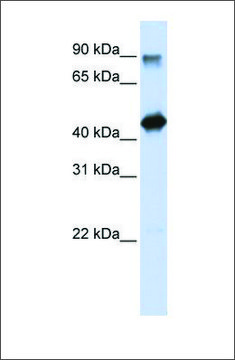 Anti-HMG20A antibody produced in rabbit affinity isolated antibody