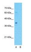 Anti-ARG2 antibody produced in rabbit affinity isolated antibody
