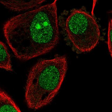 Anti-ATP6V1G1 antibody produced in rabbit Prestige Antibodies&#174; Powered by Atlas Antibodies, affinity isolated antibody