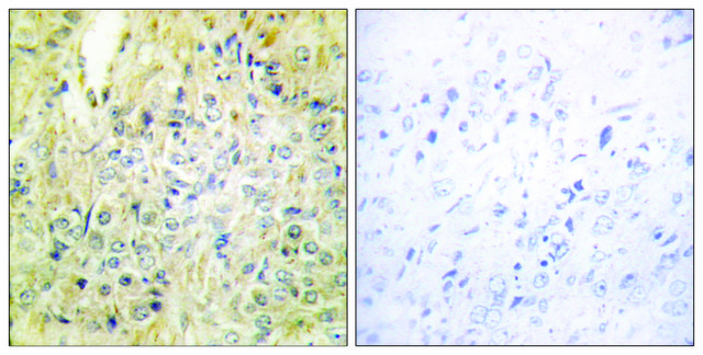 Anti-DLEC1 antibody produced in rabbit affinity isolated antibody