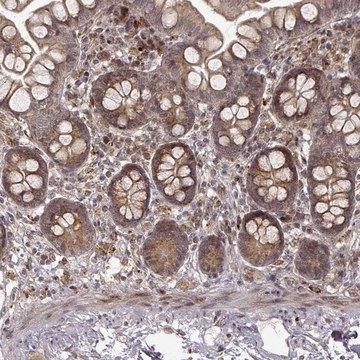 Anti-SLC12A9 antibody produced in rabbit Prestige Antibodies&#174; Powered by Atlas Antibodies, affinity isolated antibody