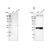 Anti-SSR1 antibody produced in rabbit Prestige Antibodies® Powered by Atlas Antibodies, affinity isolated antibody, buffered aqueous glycerol solution