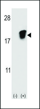 ANTI-SNRPD1 (CENTER) antibody produced in rabbit purified immunoglobulin, buffered aqueous solution