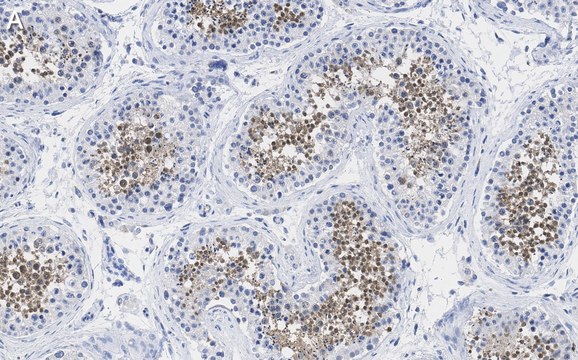 Anti-PPP3CC Antibody, clone 2C2 ZooMAb&#174; Rabbit Monoclonal recombinant, expressed in HEK 293 cells