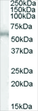 抗-ADRB1 山羊抗 affinity isolated antibody, buffered aqueous solution