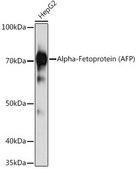 Anti-Alpha-Fetoprotein (AFP) antibody produced in mouse