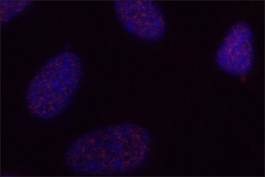 Anti-phospho-AKT (pThr450) antibody, Mouse monoclonal clone AK-11, purified from hybridoma cell culture