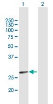 Anti-HSD17B3 antibody produced in mouse purified immunoglobulin, buffered aqueous solution