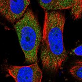 Anti-MOCS2 antibody produced in rabbit Prestige Antibodies® Powered by Atlas Antibodies, affinity isolated antibody, buffered aqueous glycerol solution