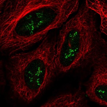 Anti-TMEM177 antibody produced in rabbit Prestige Antibodies&#174; Powered by Atlas Antibodies, affinity isolated antibody