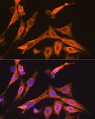Anti-S100A6 Antibody, clone 0J1Q5, Rabbit Monoclonal