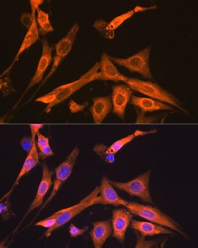 Anti-S100A6 Antibody, clone 0J1Q5, Rabbit Monoclonal