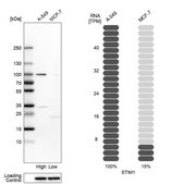 Anti-STIM1 antibody produced in rabbit Prestige Antibodies® Powered by Atlas Antibodies, affinity isolated antibody, buffered aqueous glycerol solution