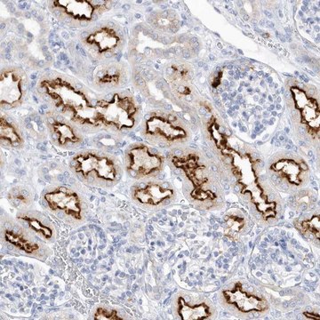 Anti-RPE antibody produced in rabbit Prestige Antibodies&#174; Powered by Atlas Antibodies, affinity isolated antibody, buffered aqueous glycerol solution