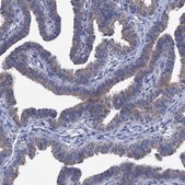 Anti-SVEP1 antibody produced in rabbit Prestige Antibodies® Powered by Atlas Antibodies, affinity isolated antibody, buffered aqueous glycerol solution, Ab2