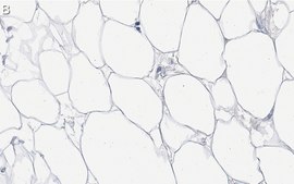 Anti-FASN Antibody, clone 2C13 ZooMAb® Rabbit Monoclonal recombinant, expressed in HEK 293 cells
