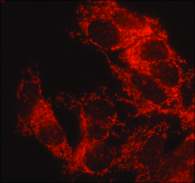 Anti-&#945;1,2-Mannosidase IA antibody produced in rabbit affinity isolated antibody, buffered aqueous solution