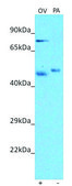 Anti-PIEZO2 (N-terminal) antibody produced in rabbit affinity isolated antibody