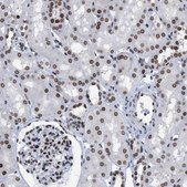 Anti-TPR antibody produced in rabbit Prestige Antibodies® Powered by Atlas Antibodies, affinity isolated antibody, buffered aqueous glycerol solution
