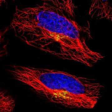 Anti-ATP7A antibody produced in rabbit Prestige Antibodies&#174; Powered by Atlas Antibodies, affinity isolated antibody