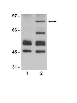 抗乙酰基p53抗体（Lys373，Lys382） serum, Upstate&#174;