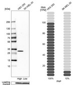 ANTI-PNP antibody produced in rabbit Prestige Antibodies® Powered by Atlas Antibodies, affinity isolated antibody, buffered aqueous glycerol solution