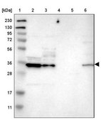 Anti-CBR3 antibody produced in rabbit Prestige Antibodies® Powered by Atlas Antibodies, affinity isolated antibody, buffered aqueous glycerol solution