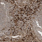 Anti-DDIT4 antibody produced in rabbit Prestige Antibodies® Powered by Atlas Antibodies, affinity isolated antibody, buffered aqueous glycerol solution