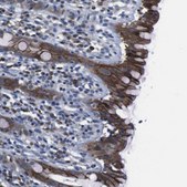 Anti-SEMA4B antibody produced in rabbit Prestige Antibodies® Powered by Atlas Antibodies, affinity isolated antibody, buffered aqueous glycerol solution